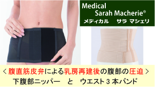 腹直筋皮弁法による乳房再建後の腹部の圧迫は下腹部ニッパーがお勧め。